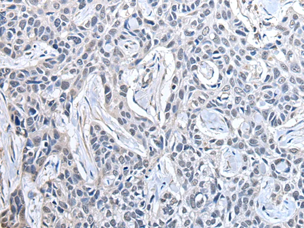 PPIG Rabbit Polyclonal Antibody - image 1