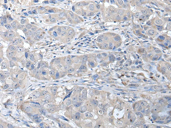 RASSF8 Rabbit Polyclonal Antibody - image 1