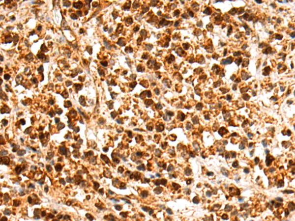AF9 (MLLT3) Rabbit Polyclonal Antibody - image 1
