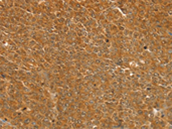 ST18 Rabbit Polyclonal Antibody - image 1