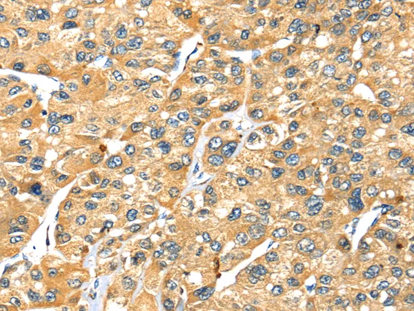 Syntaxin 7 (STX7) Rabbit Polyclonal Antibody - image 1