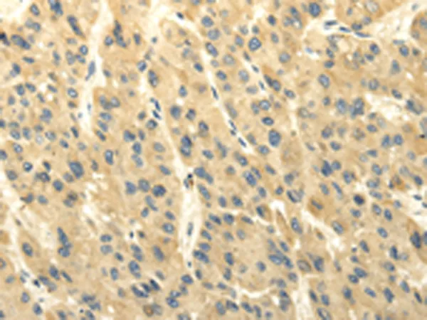 ABCB7 Rabbit Polyclonal Antibody - image 1