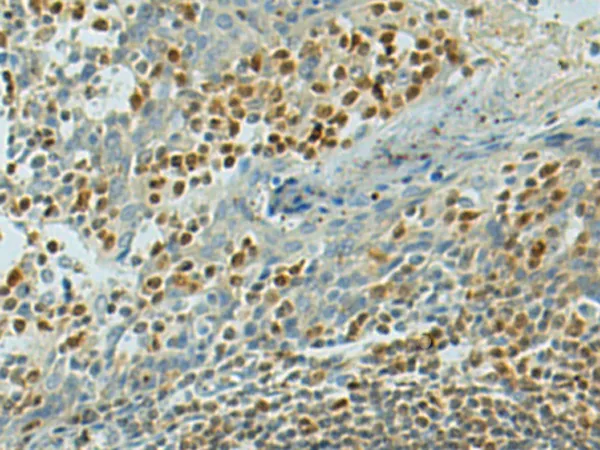 TFEB Rabbit Polyclonal Antibody - image 1