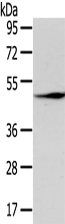 LEFTY2 Rabbit Polyclonal Antibody - image 1