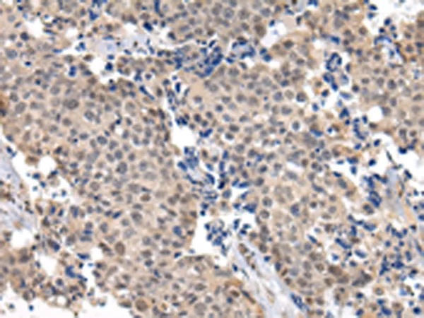USF1 Rabbit Polyclonal Antibody - image 1