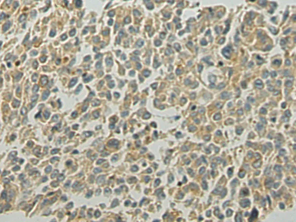 VPS39 Rabbit Polyclonal Antibody - image 1