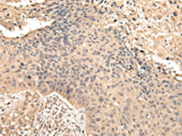VPS35 Rabbit Polyclonal Antibody - image 1