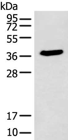 ACBD4 Rabbit Polyclonal Antibody - image 1