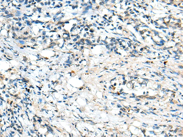 Complement factor B (CFB) Rabbit Polyclonal Antibody - image 1
