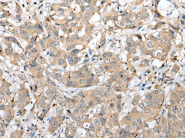 CAPS2 Rabbit Polyclonal Antibody - image 1