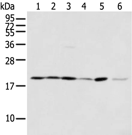EEF1E1 Rabbit Polyclonal Antibody - image 1