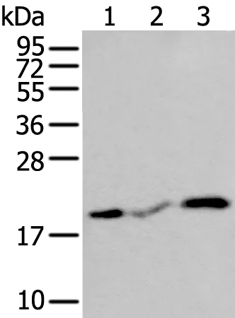CSRP3 Rabbit Polyclonal Antibody - image 1