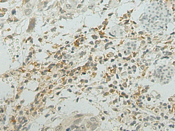 Major Basic Protein (PRG2) Rabbit Polyclonal Antibody - image 1