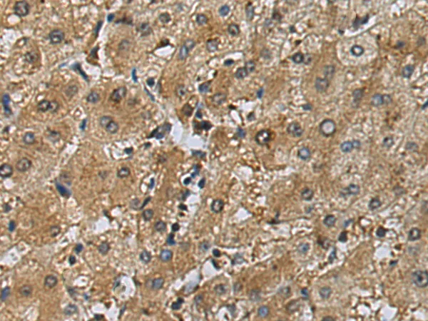 DNAJB9 Rabbit Polyclonal Antibody - image 1