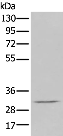 DECR2 Rabbit Polyclonal Antibody - image 1