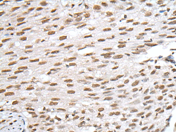 VSX1 Rabbit Polyclonal Antibody - image 1