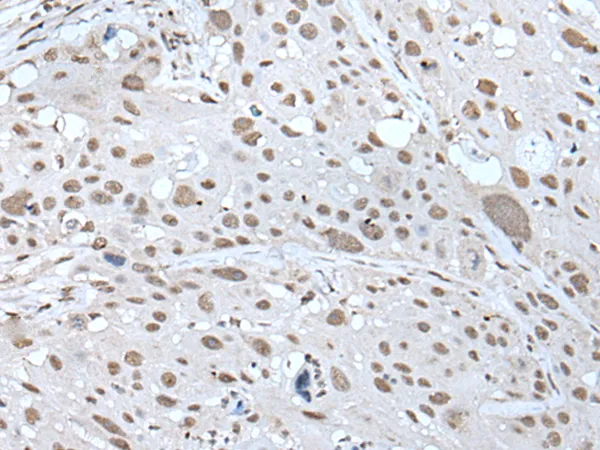 U2AF65 (U2AF2) Rabbit Polyclonal Antibody - image 1