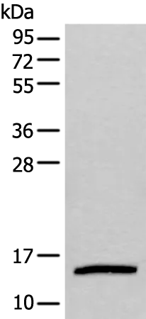 UBE2D3 Rabbit Polyclonal Antibody - image 1