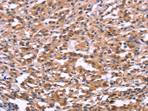 USP2 Rabbit Polyclonal Antibody - image 1