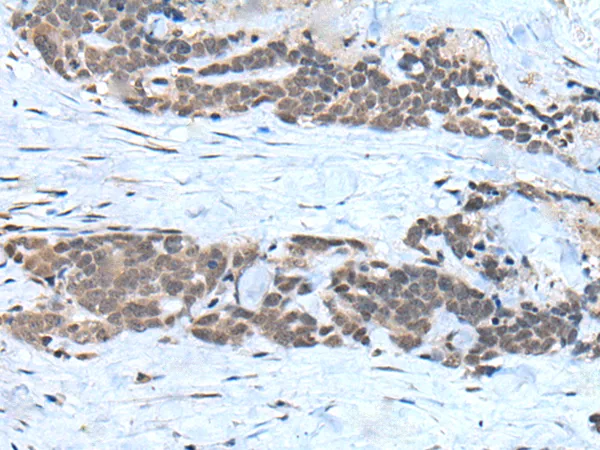 USP3 Rabbit Polyclonal Antibody - image 1