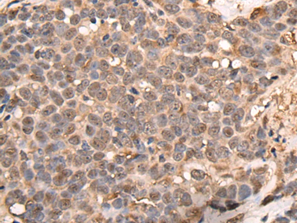 ATRIP Rabbit Polyclonal Antibody - image 1