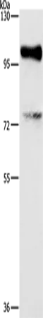 EZH2 Rabbit Polyclonal Antibody - image 1