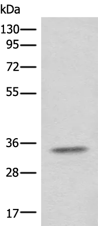 CFAP298 Rabbit Polyclonal Antibody - image 1