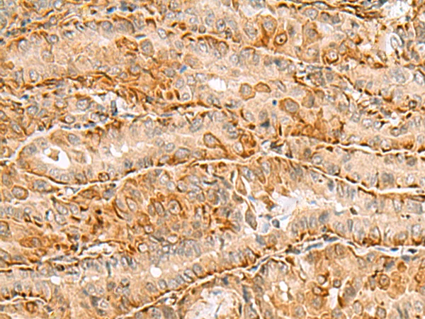 C3orf38 Rabbit Polyclonal Antibody - image 1