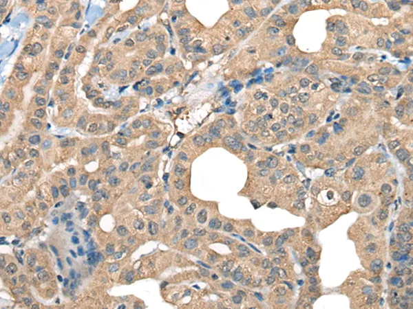 CABP5 Rabbit Polyclonal Antibody - image 1