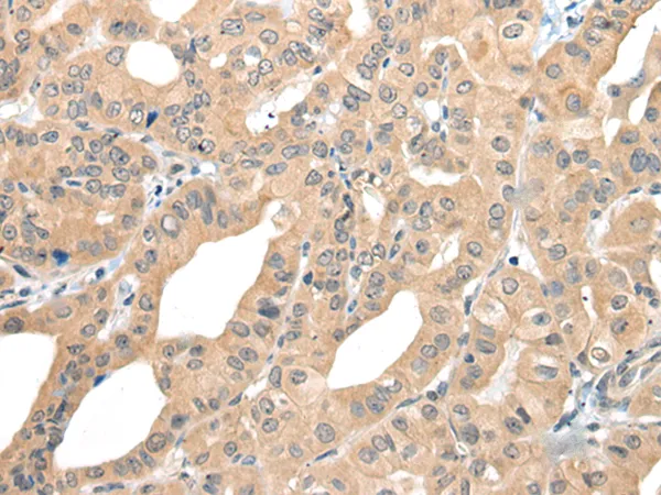 CAGE1 Rabbit Polyclonal Antibody - image 1