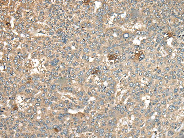 Carbonic Anhydrase XI (CA11) Rabbit Polyclonal Antibody - image 1