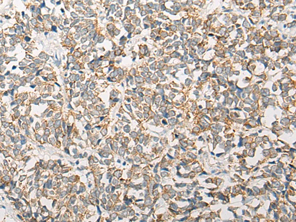 CORO2A Rabbit Polyclonal Antibody - image 1