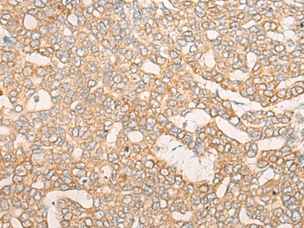 CORO7 Rabbit Polyclonal Antibody - image 1