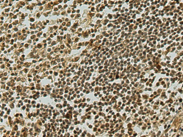 MIER1 Rabbit Polyclonal Antibody - image 1