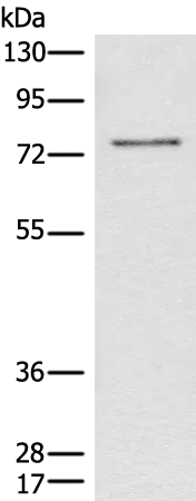 CCNK Rabbit Polyclonal Antibody - image 1