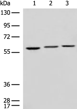 DAK (TKFC) Rabbit Polyclonal Antibody - image 1