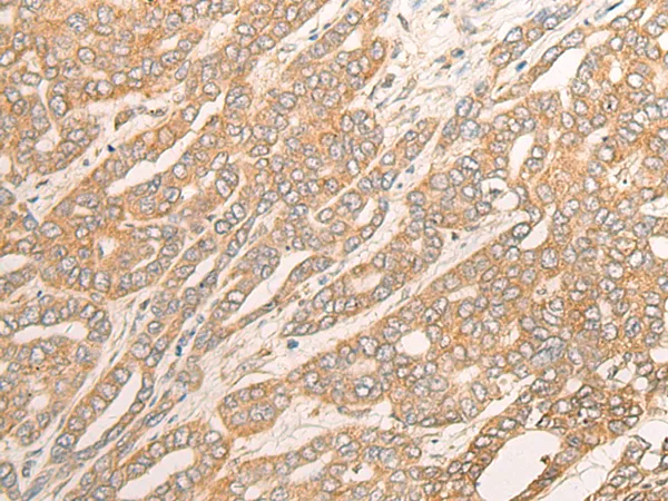 DCTD Rabbit Polyclonal Antibody - image 1