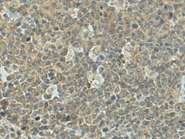 DENND1A Rabbit Polyclonal Antibody - image 1
