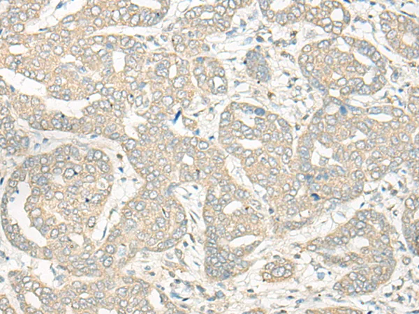 HLA-DRB5 Rabbit Polyclonal Antibody - image 1