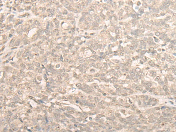 NUBP2 Rabbit Polyclonal Antibody - image 1