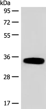 DHRS1 Rabbit Polyclonal Antibody - image 1