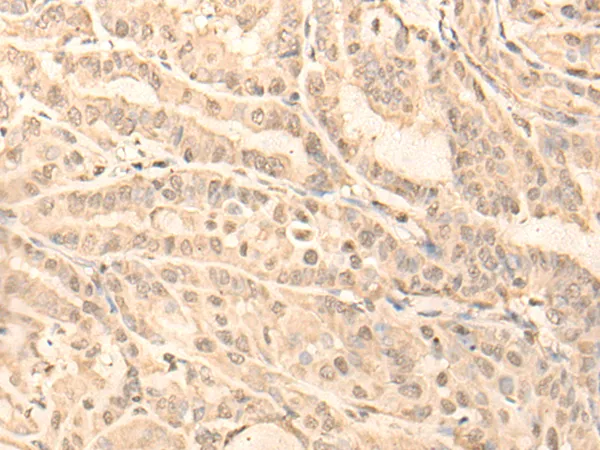 TADA3L (TADA3) Rabbit Polyclonal Antibody - image 1