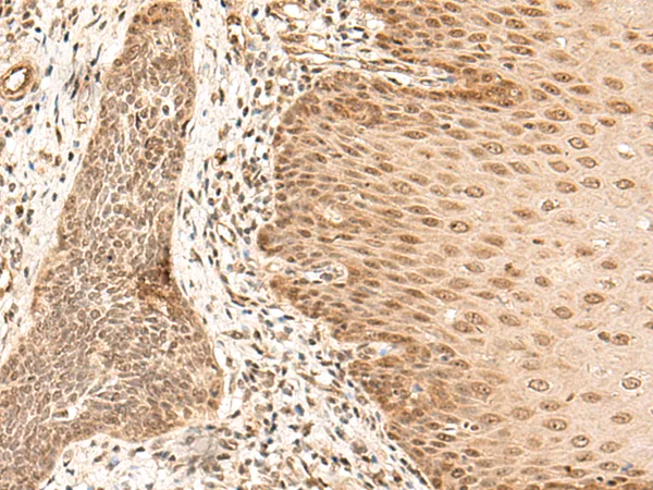 ARMC8 Rabbit Polyclonal Antibody - image 1