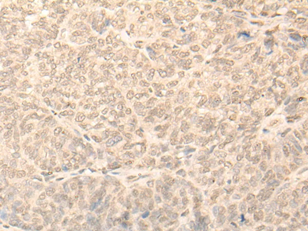 NARF Rabbit Polyclonal Antibody - image 1