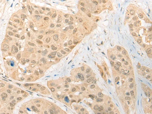 CDCA4 Rabbit Polyclonal Antibody - image 1
