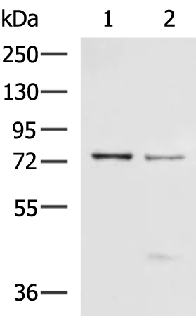 p63 (TP63) Rabbit Polyclonal Antibody - image 1