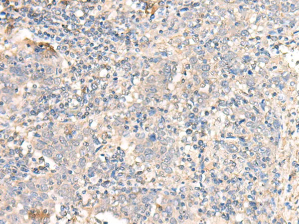 PARS2 Rabbit Polyclonal Antibody - image 1