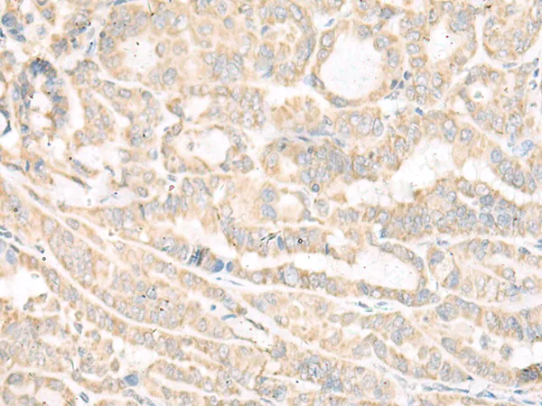 ACSF2 Rabbit Polyclonal Antibody - image 1