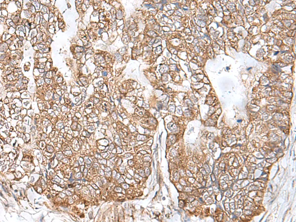 RNF111 Rabbit Polyclonal Antibody - image 1