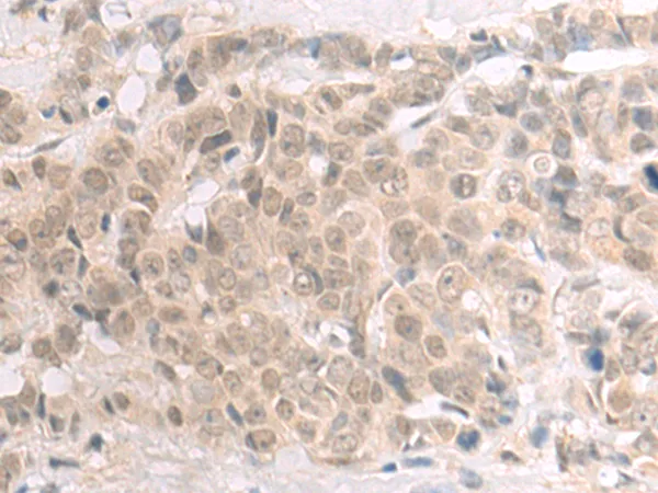 POLR2D Rabbit Polyclonal Antibody - image 1